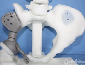 三维打印技术在硬组织外科临床医学中的应用现状与未来展望